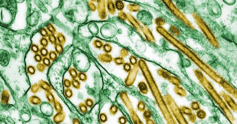 CDC confirms first case of severe bird flu in US