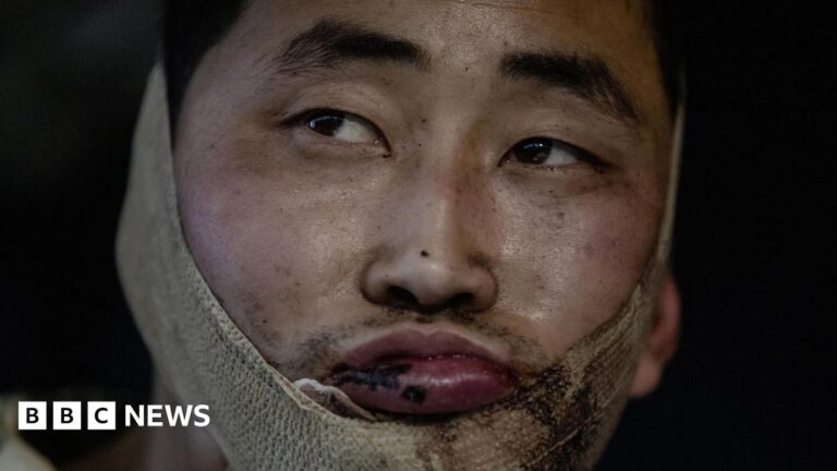 Ukraine says it captured two wounded North Korean soldiers in Russia