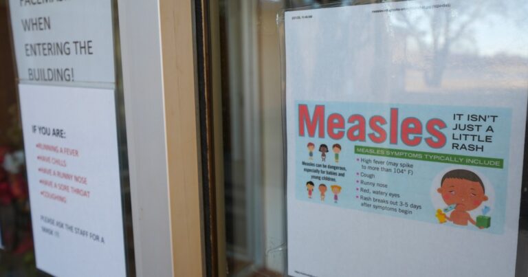 The United States has been reporting the first measles since 2015 Health News
