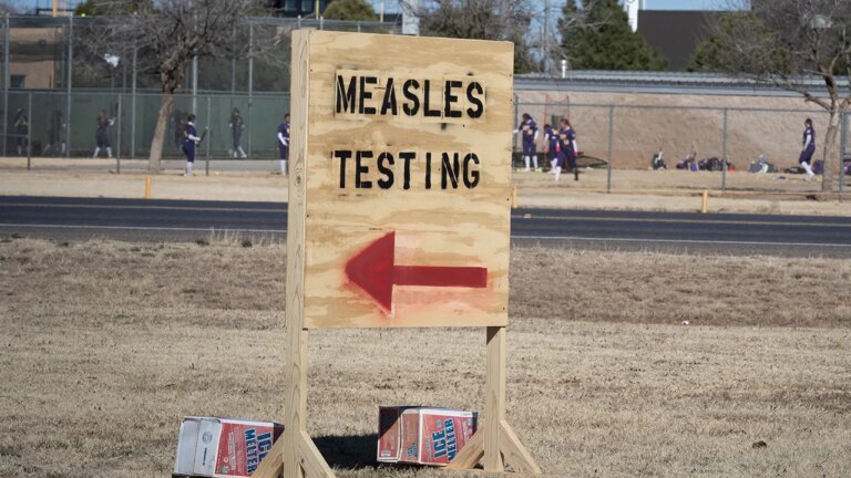 New Mexico, the adults infected with measles died