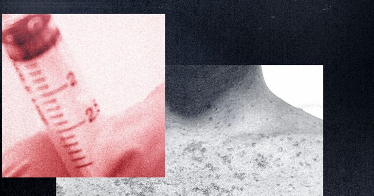 Anti-Vaxxers erupted from the outbreak of measles-and claim that organic land has caused it that it has caused it