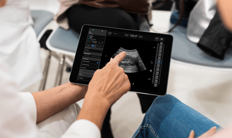 Samsung can invest in $ 100 million round to start medical images EXO