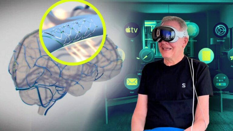 Coming soon to Apple Devices: Brain Accessibility Functions